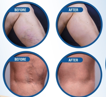 The Chicago Vein Care Center