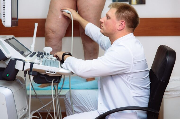 The Varicose Veins in Chicago