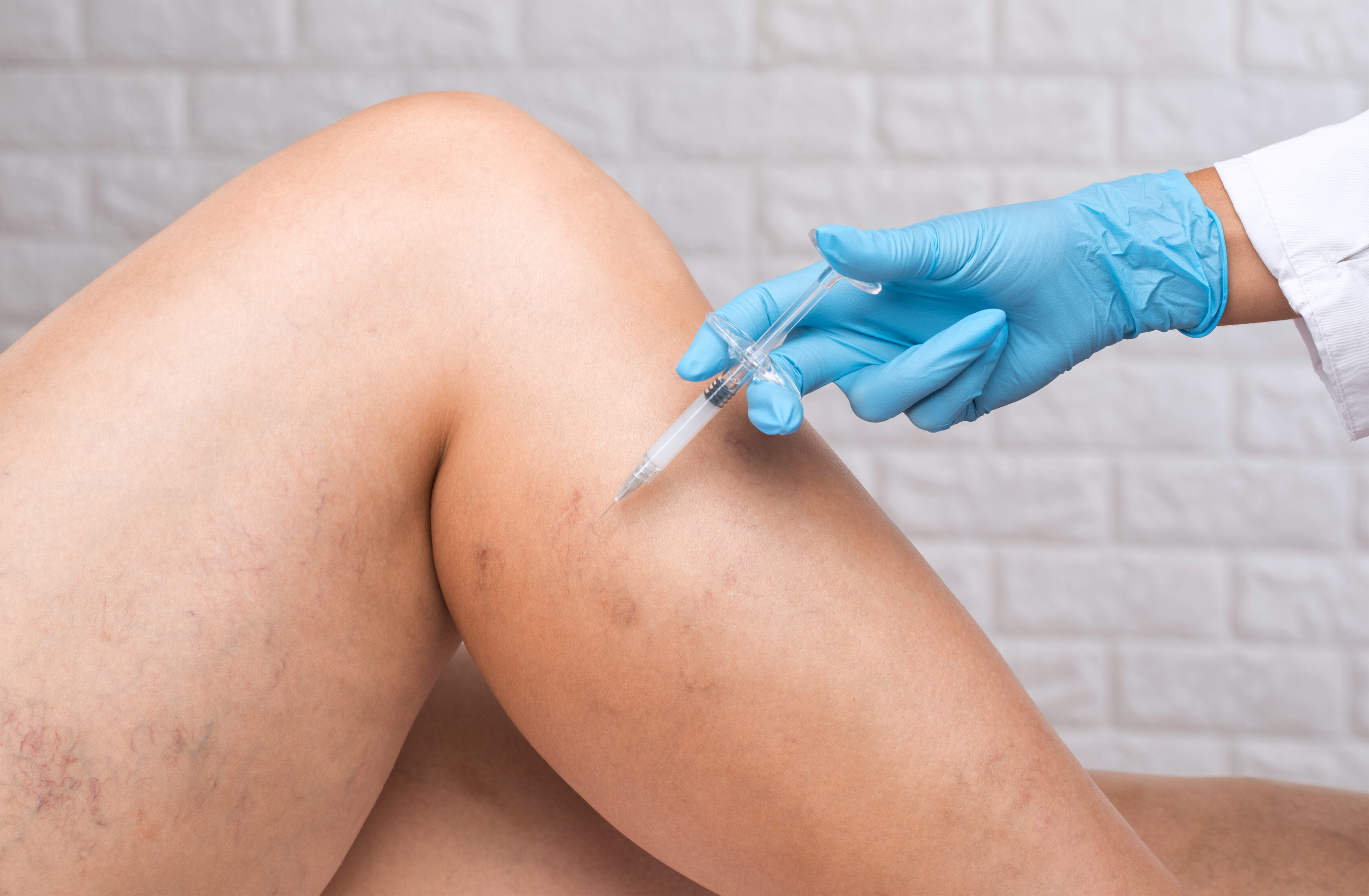 The Varicose Vein Clinic Near ME
