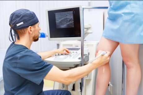 Varicose Veins Laser Treatment