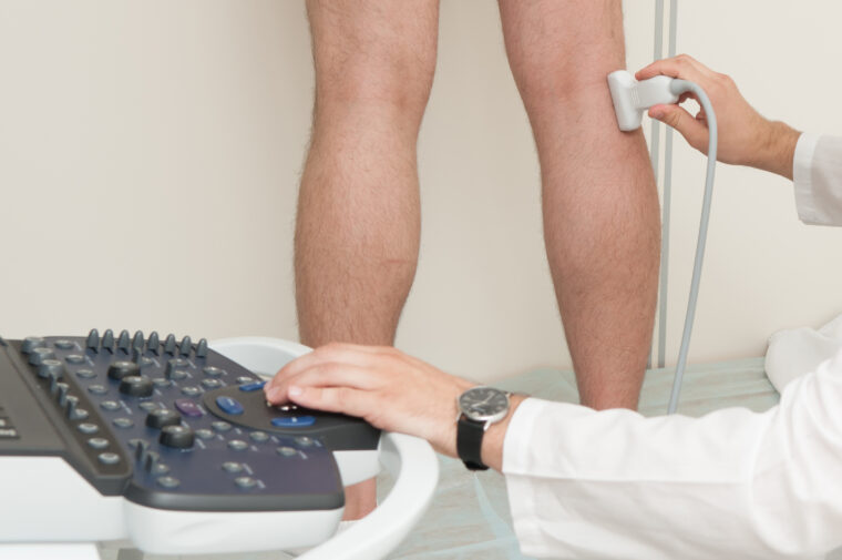 Vein Vascular Surgeon