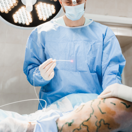 Varicose veins surgery