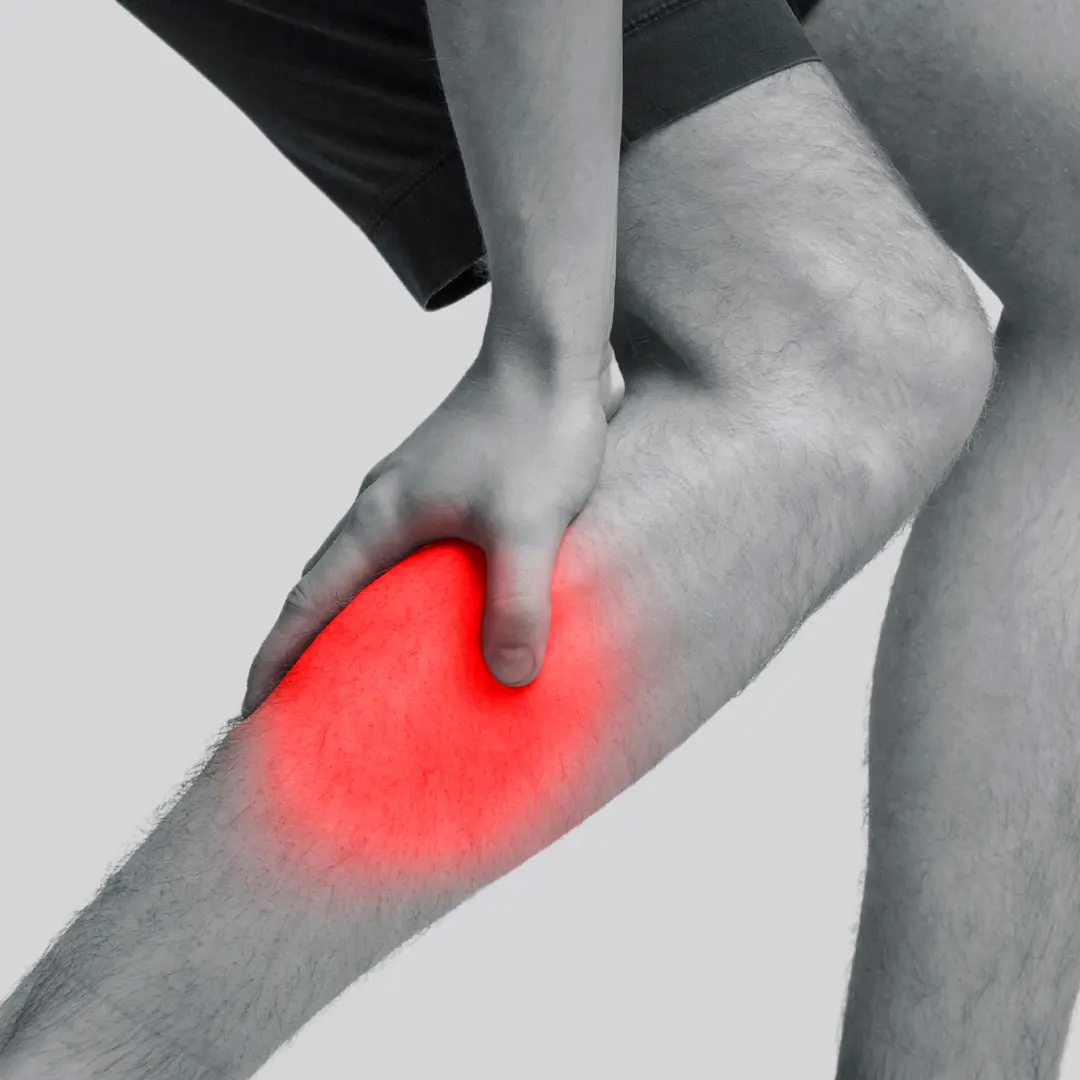 Best Varicose veins risk factors