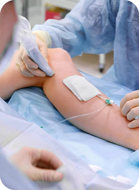 EVLA Treatment for lower legs