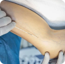 Charming Skin Vein Clinics Skin Treatment