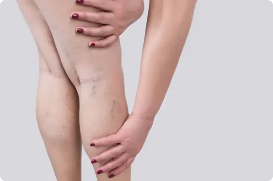 women having a leg problem