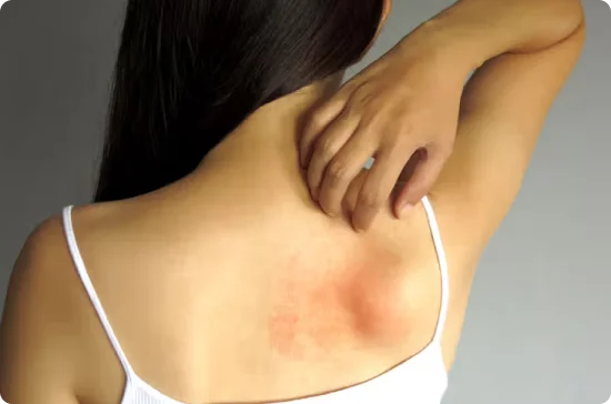 Women having itchy back