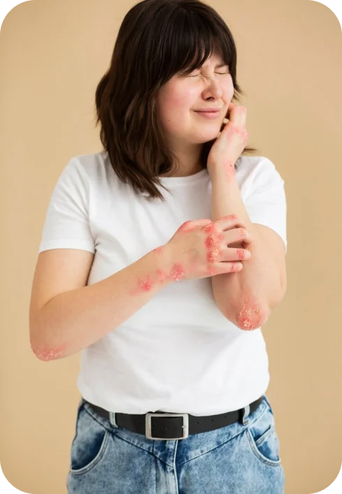 Poor circulation rash