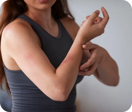 Arm slightly irritated