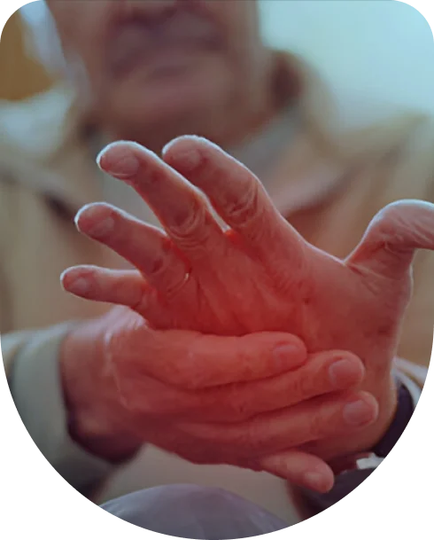 Hand of an old man swelling