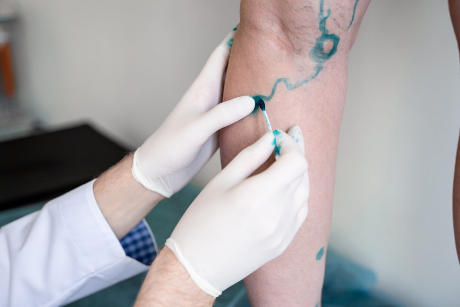 Varicose Vein Doctor