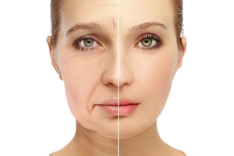 Fat Transfer to make face balance