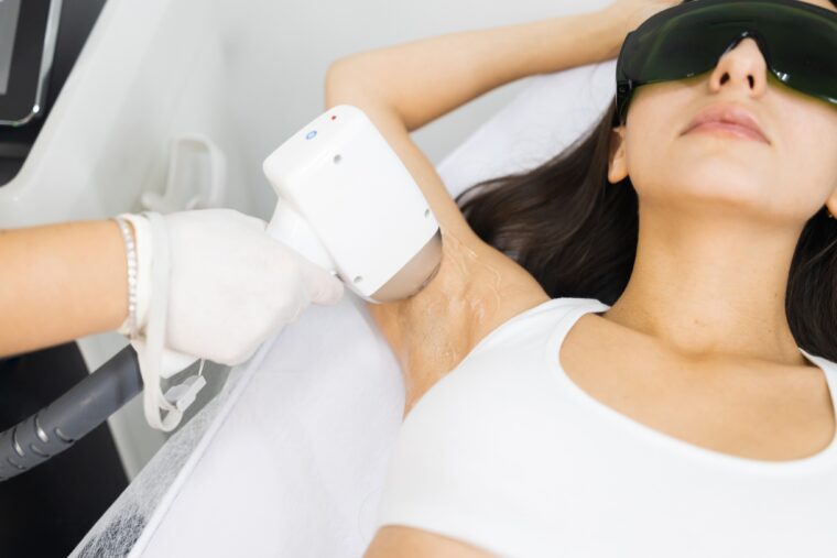 laser hair removal in underarm