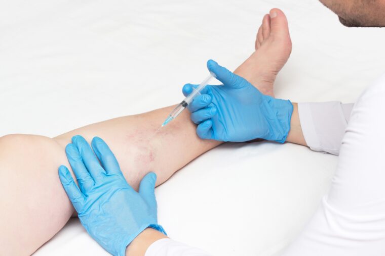 Varicose Vein Doctors