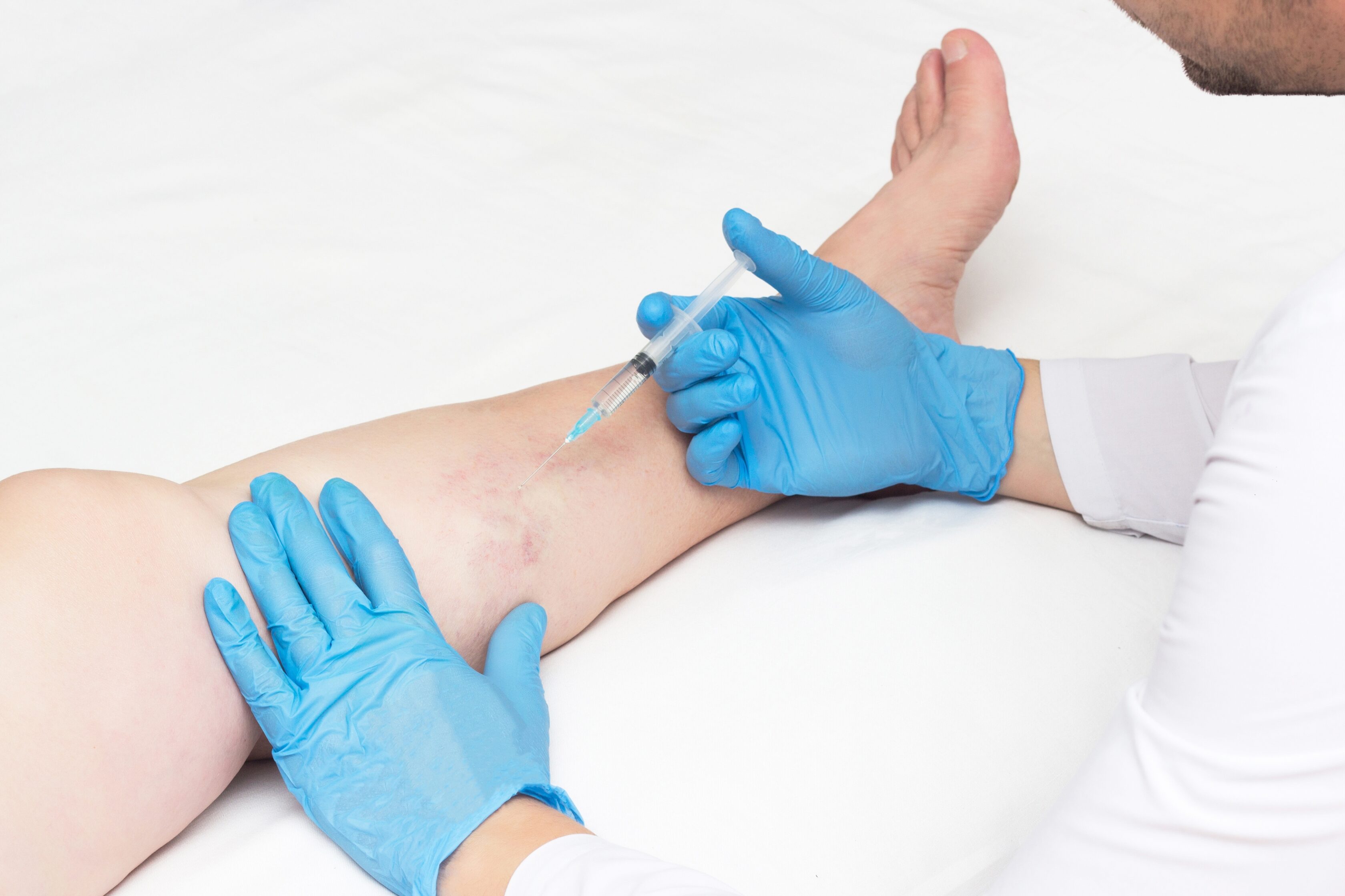 Varicose Vein Doctors