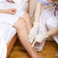 Varicose Veins