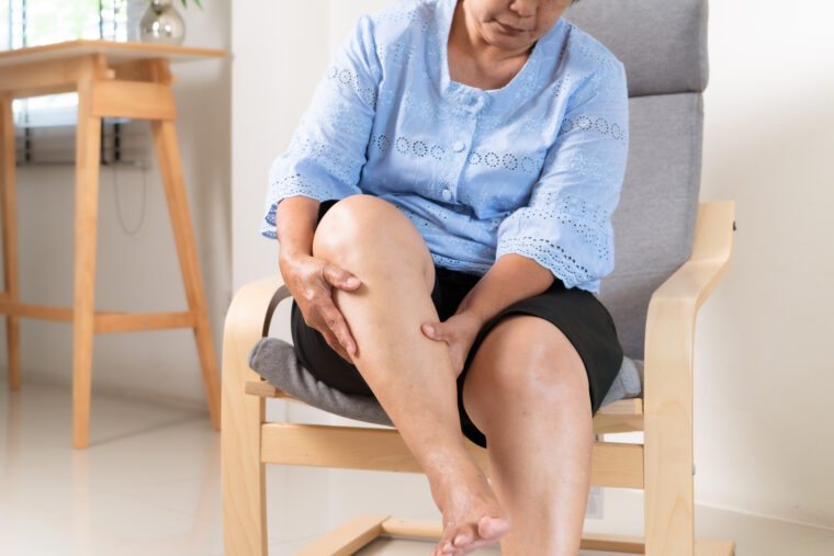 Uncategorized Lifestyle Changes That Can Help Manage Varicose Veins