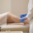 Veins Specialist Who Is the Right Veins Specialist for Treatment?