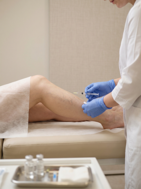 What Is the Best Treatment for Varicose Veins? 1 Varicose veins What Is the Best Treatment for Varicose Veins?
