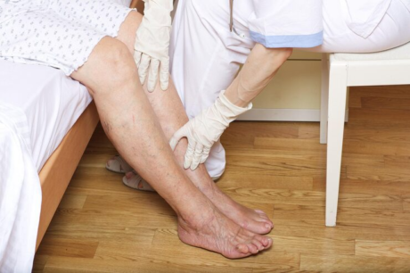 Veins Specialist Best Veins Specialist for Same Day Consultation Help