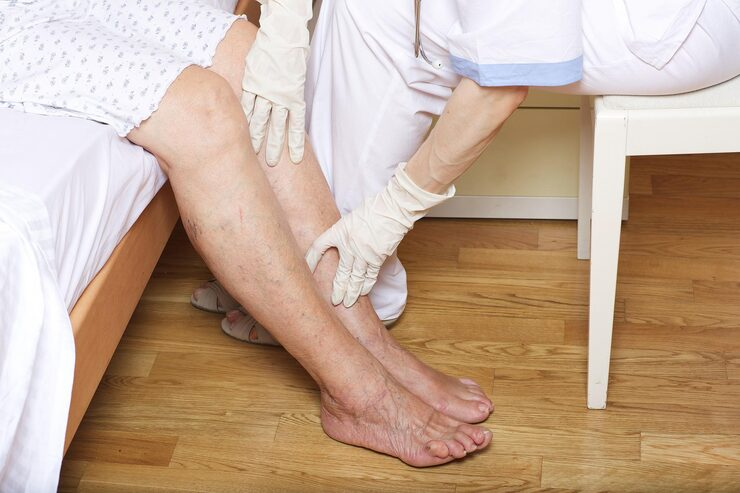 Wound Care Wound Care