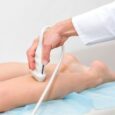 Varicose Veins Your Local Vascular Surgeon: Health & Treatment Tips