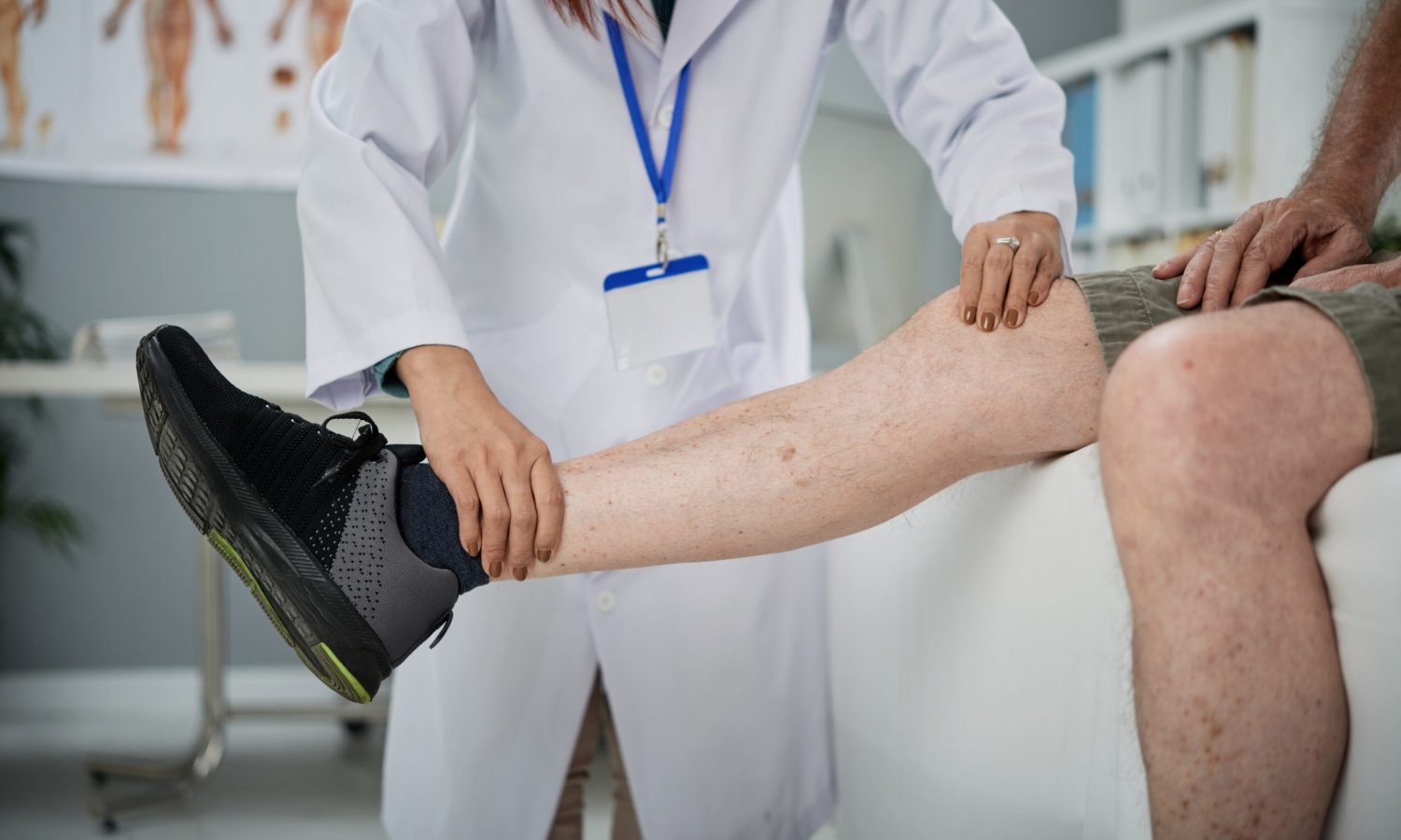 Varicose Veins